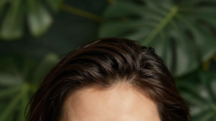 Why Weight Loss and GLP-1 Medications Can Trigger Hair Shedding: What the Evidence Shows